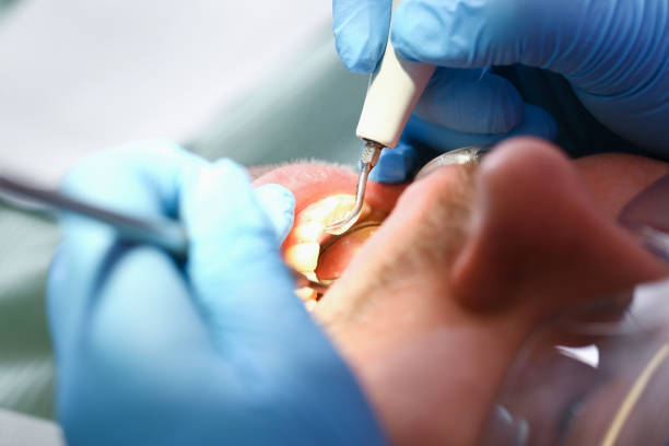 Best Emergency Gum Pain Relief  in Cut Off, LA