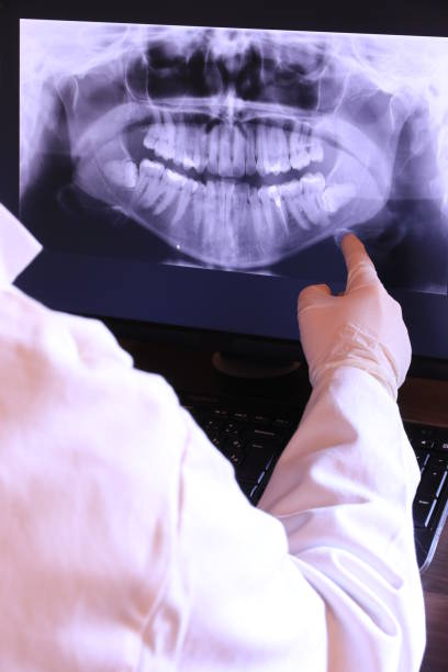 Best Emergency Tooth Extraction  in Cut Off, LA