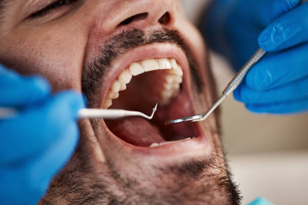 Best Emergency Dental Services Near Me  in Cut Off, LA