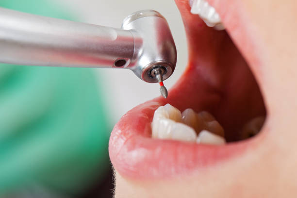 Best Emergency Gum Pain Relief  in Cut Off, LA